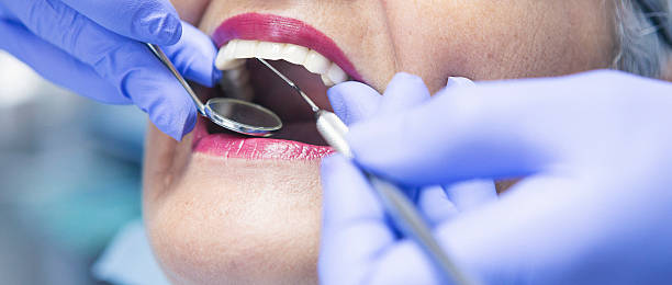Best Emergency Tooth Extraction in Valparaiso, FL