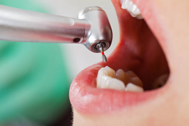 Best Urgent Care for Lost Fillings or Crowns in Valparaiso, FL